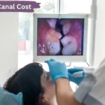 Root Canal Cost